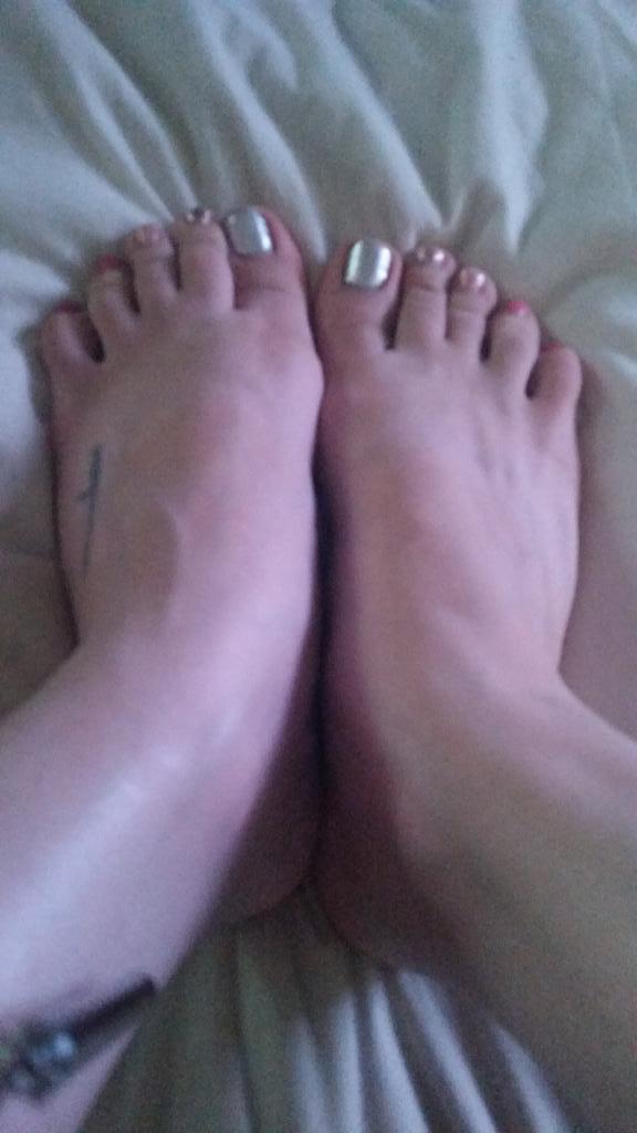 Michelle moist feet