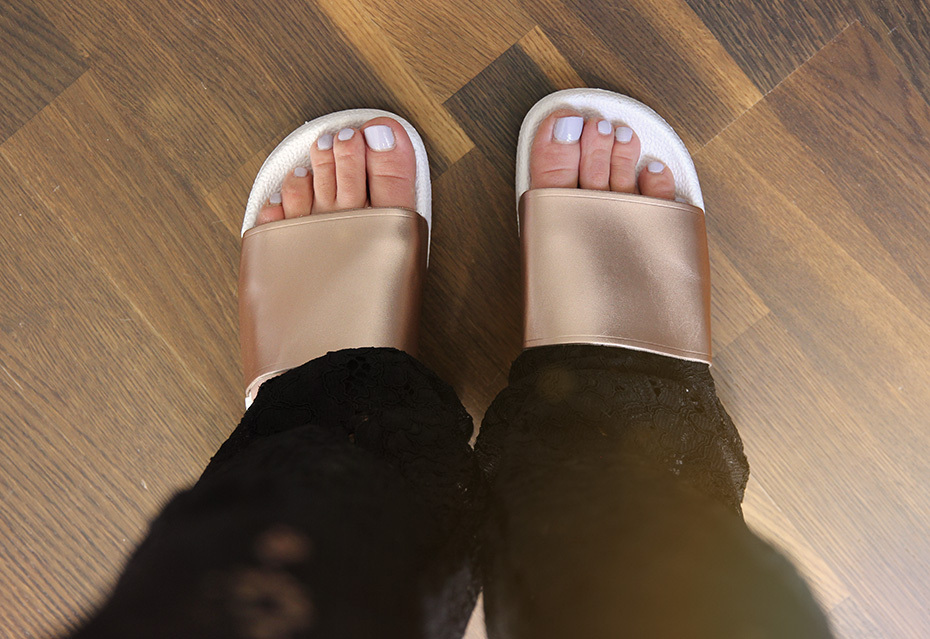 Alexandra feet