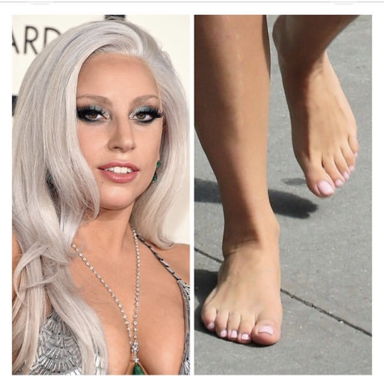 Lady Gaga And Those Toes Fee