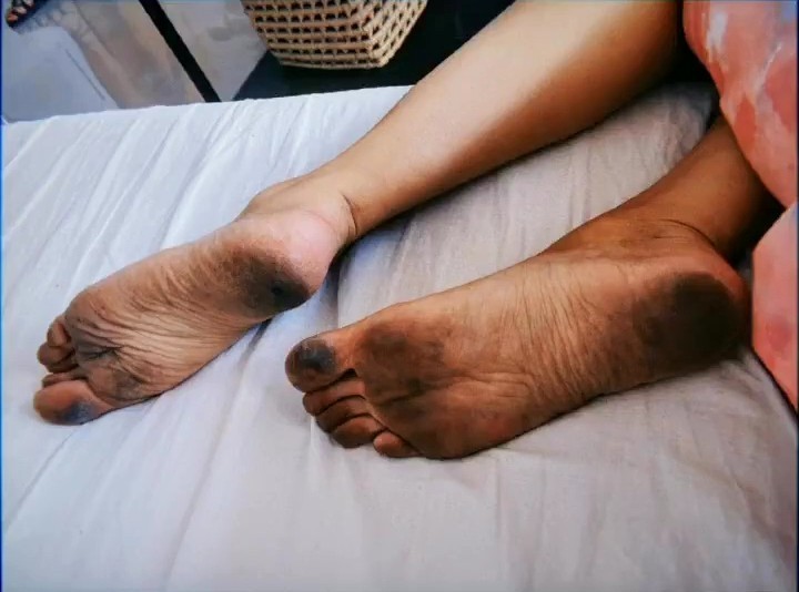Agustina Suasquita Feet